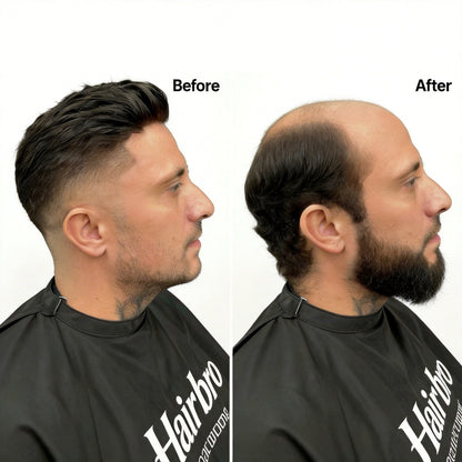 All French Lace Hair Replacement System