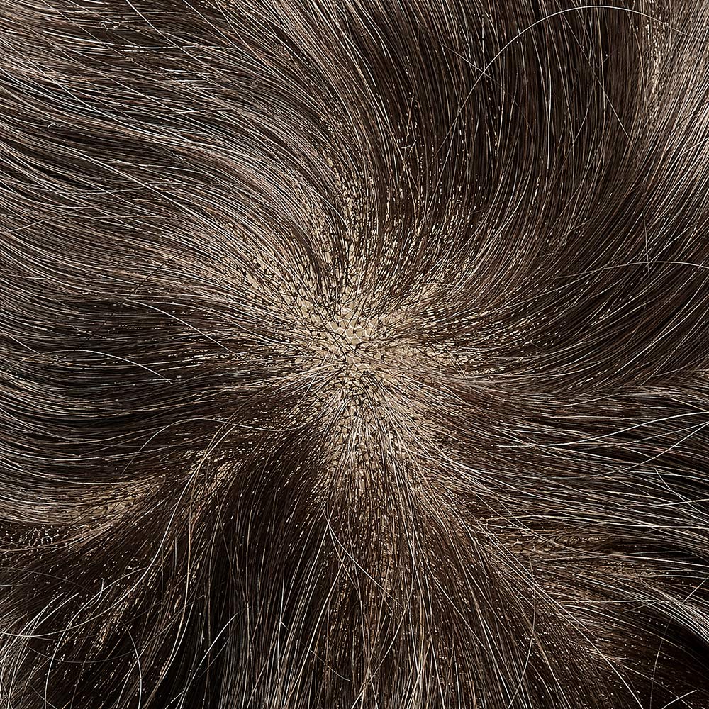 BH Swiss Lace Human Hair Breathable Hair Replacement System For Man - HairBro