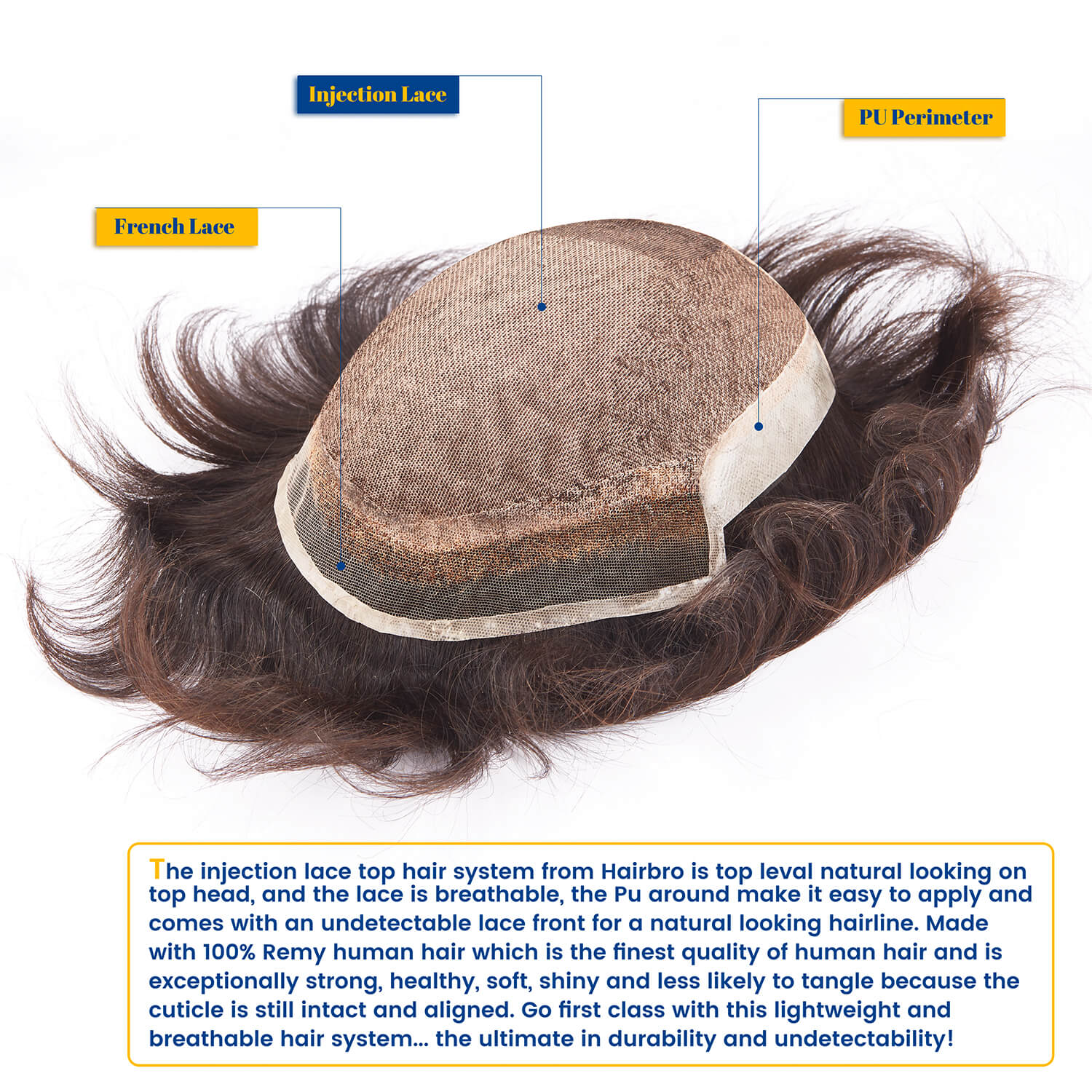 Injection Lace Top French Lace Front Poly Side and Back Hair Replacement System - HairBro